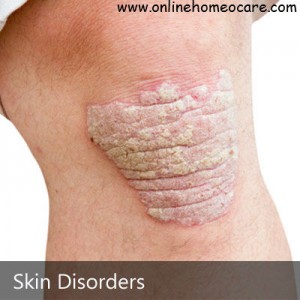 Read more about the article Homeopathy remedies for Skin Disorders