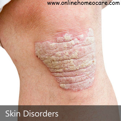 You are currently viewing Homeopathy remedies for Skin Disorders