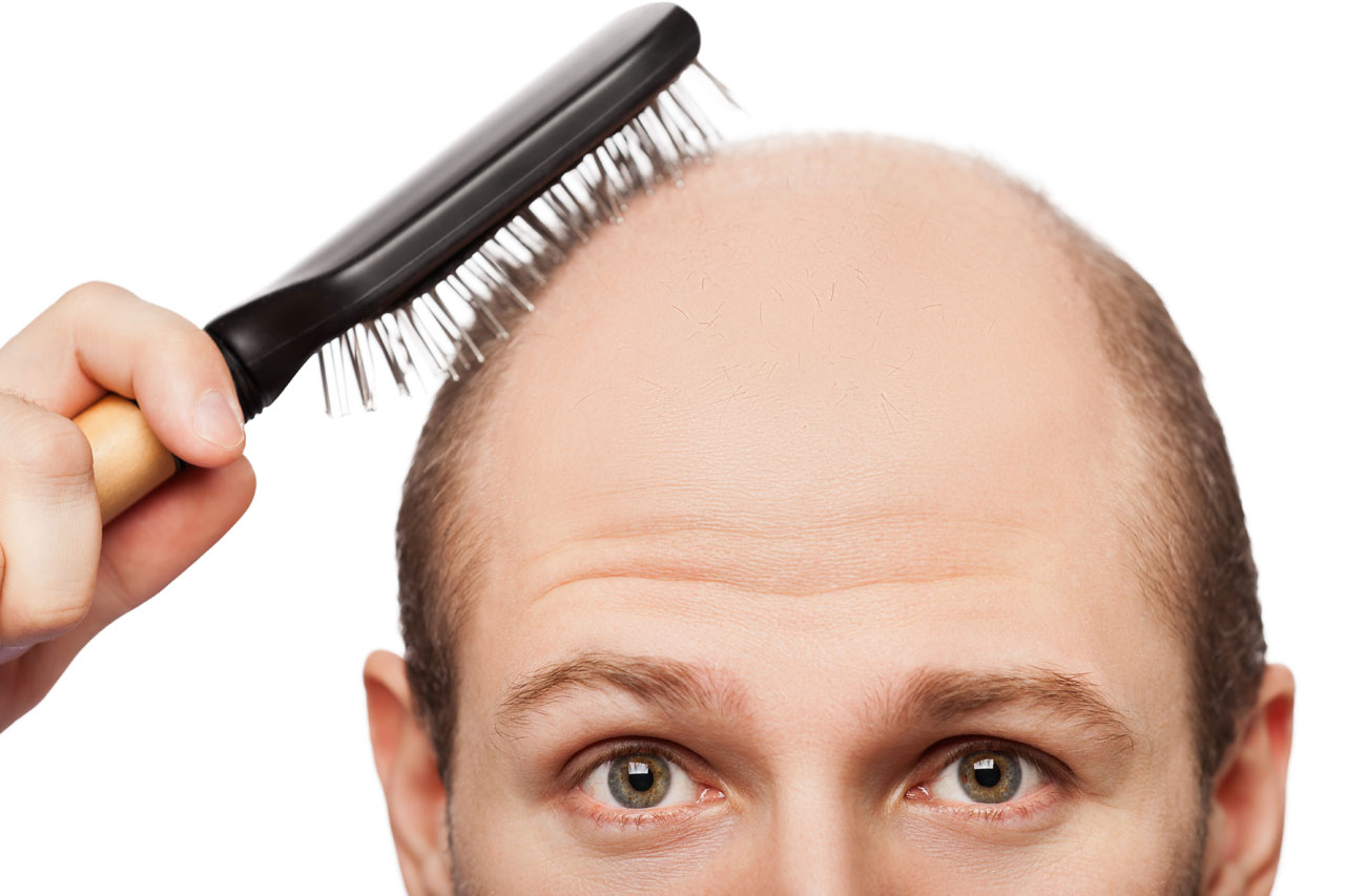 Hair loss Treatment