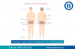 Homeopathy Treatment for Psoriasis