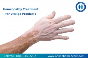 Homeopathy Treatment for Vitiligo problems
