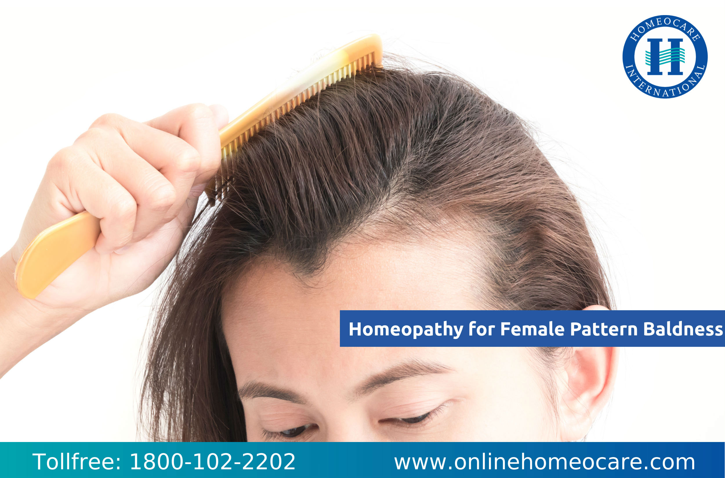 Read more about the article Reasons of Female Pattern Baldness