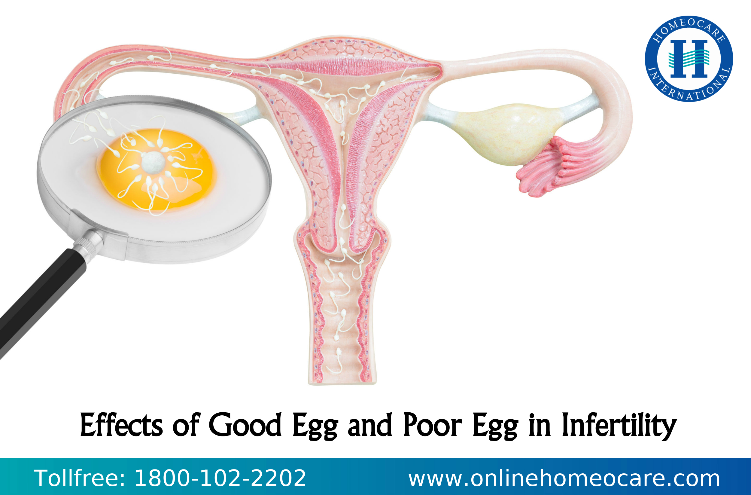 Poor egg in infertility